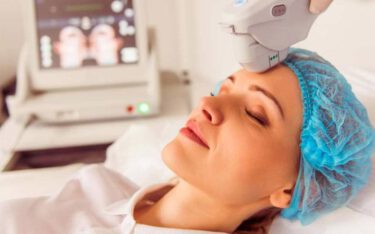 رفع چین و چروک با هایفوتراپی